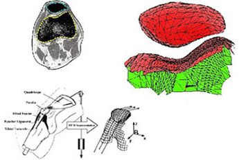 Patella Tracking Study