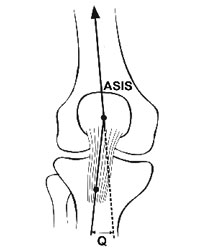 Q-angle